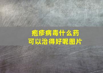 疱疹病毒什么药可以治得好呢图片