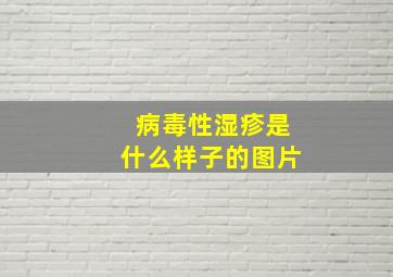 病毒性湿疹是什么样子的图片