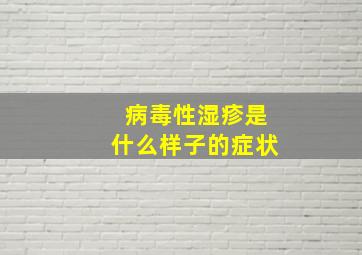 病毒性湿疹是什么样子的症状