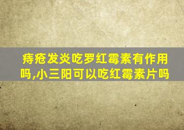 痔疮发炎吃罗红霉素有作用吗,小三阳可以吃红霉素片吗