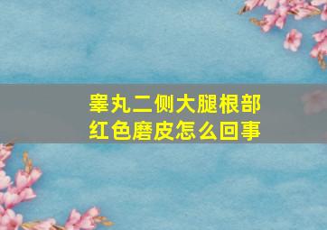 睾丸二侧大腿根部红色磨皮怎么回事