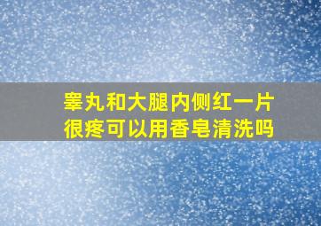 睾丸和大腿内侧红一片很疼可以用香皂清洗吗