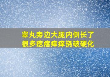 睾丸旁边大腿内侧长了很多疙瘩痒痒挠破硬化