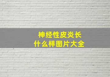 神经性皮炎长什么样图片大全