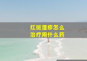 红斑湿疹怎么治疗用什么药