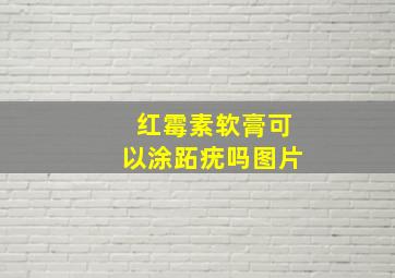 红霉素软膏可以涂跖疣吗图片