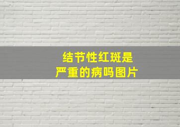 结节性红斑是严重的病吗图片