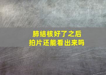 肺结核好了之后拍片还能看出来吗