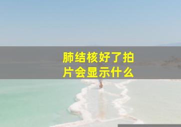 肺结核好了拍片会显示什么