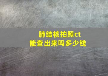 肺结核拍照ct能查出来吗多少钱