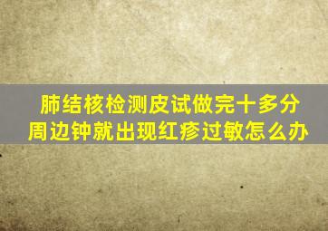 肺结核检测皮试做完十多分周边钟就出现红疹过敏怎么办