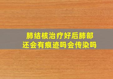 肺结核治疗好后肺部还会有痕迹吗会传染吗