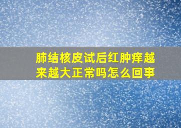 肺结核皮试后红肿痒越来越大正常吗怎么回事