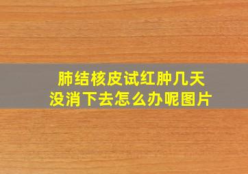 肺结核皮试红肿几天没消下去怎么办呢图片