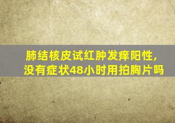 肺结核皮试红肿发痒阳性,没有症状48小时用拍胸片吗