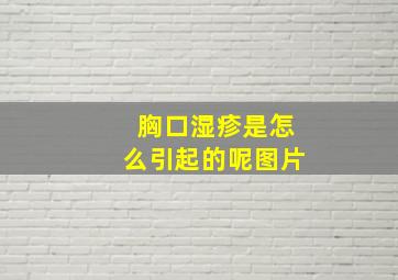 胸口湿疹是怎么引起的呢图片