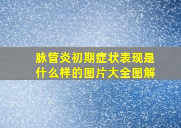 脉管炎初期症状表现是什么样的图片大全图解