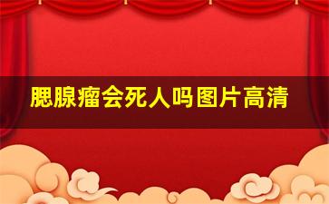 腮腺瘤会死人吗图片高清