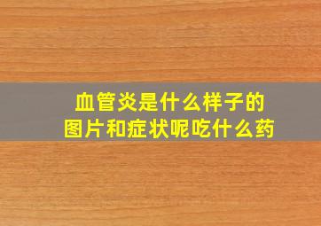 血管炎是什么样子的图片和症状呢吃什么药