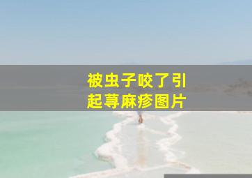 被虫子咬了引起荨麻疹图片