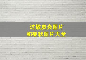 过敏皮炎图片和症状图片大全