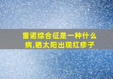 雷诺综合征是一种什么病,晒太阳出现红疹子