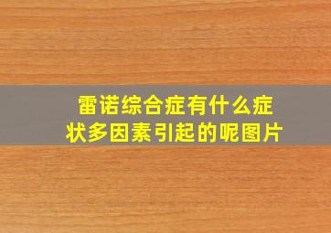 雷诺综合症有什么症状多因素引起的呢图片