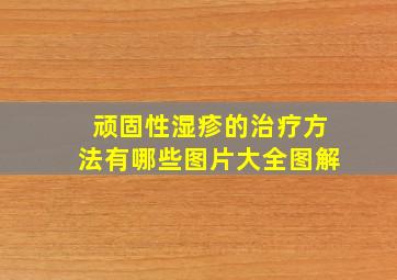 顽固性湿疹的治疗方法有哪些图片大全图解