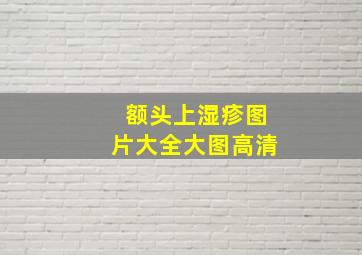 额头上湿疹图片大全大图高清