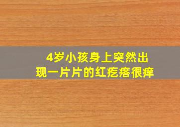 4岁小孩身上突然出现一片片的红疙瘩很痒