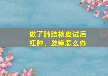 做了肺结核皮试后红肿、发痒怎么办