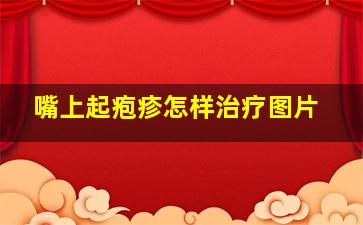 嘴上起疱疹怎样治疗图片