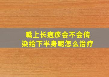 嘴上长疱疹会不会传染给下半身呢怎么治疗