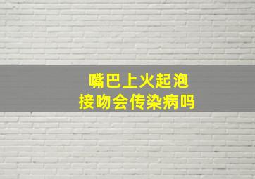 嘴巴上火起泡接吻会传染病吗