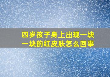 四岁孩子身上出现一块一块的红皮肤怎么回事