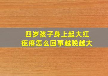 四岁孩子身上起大红疙瘩怎么回事越晚越大