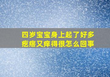 四岁宝宝身上起了好多疙瘩又痒得很怎么回事