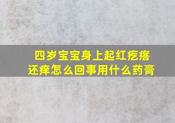 四岁宝宝身上起红疙瘩还痒怎么回事用什么药膏