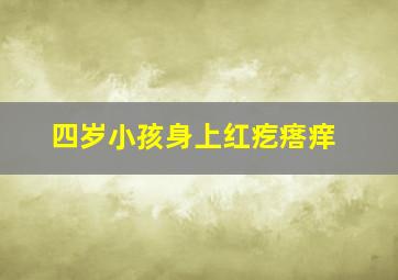 四岁小孩身上红疙瘩痒