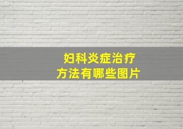 妇科炎症治疗方法有哪些图片