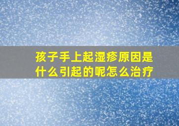 孩子手上起湿疹原因是什么引起的呢怎么治疗