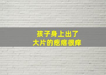 孩子身上出了大片的疙瘩很痒