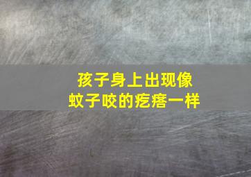 孩子身上出现像蚊子咬的疙瘩一样