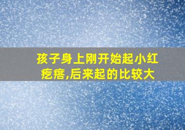 孩子身上刚开始起小红疙瘩,后来起的比较大