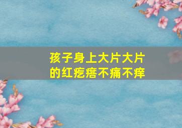 孩子身上大片大片的红疙瘩不痛不痒