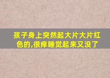 孩子身上突然起大片大片红色的,很痒睡觉起来又没了