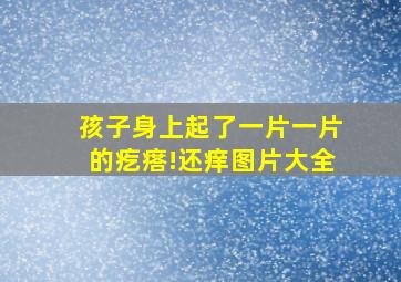 孩子身上起了一片一片的疙瘩!还痒图片大全