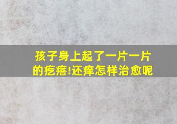 孩子身上起了一片一片的疙瘩!还痒怎样治愈呢