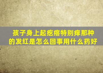 孩子身上起疙瘩特别痒那种的发红是怎么回事用什么药好