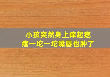 小孩突然身上痒起疙瘩一坨一坨嘴唇也肿了